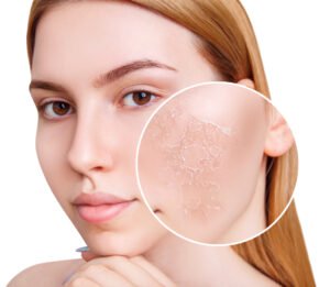 best moisturizer for dry skin in pakistan